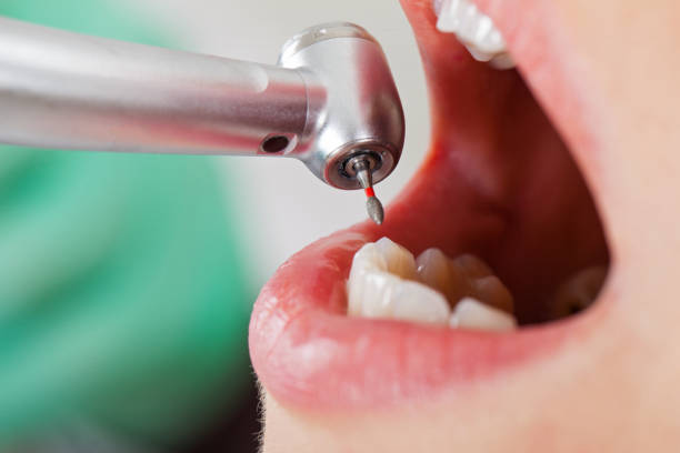 Best Mobile Emergency Dentist in Gibson City, IL